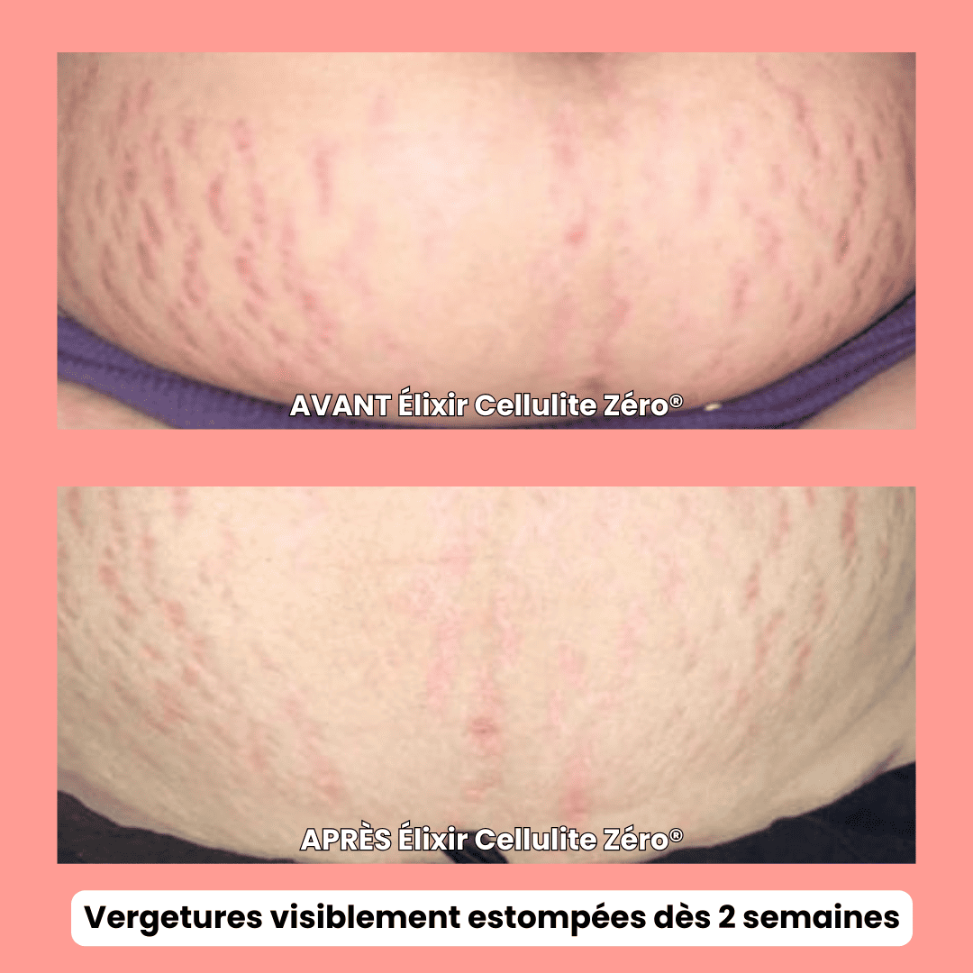 Cellulite Zéro®- Formule Nuit – Anti-Cellulite Tenace + Ultra Fermeté